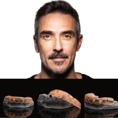 AACD Journal of Cosmetic Dentistry Advanced Interdisciplinary Treatment for Esthetic Rehabilitation of Congenitally Missing Maxillary Lateral Incisors: A Case Report